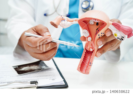 Uterus, Asian, woman holding human anatomy model. 140638622