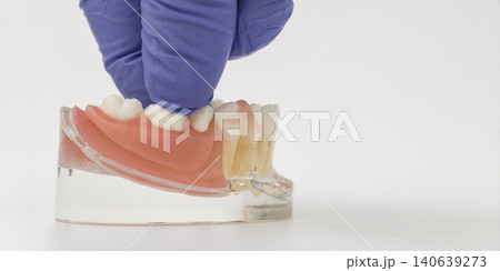 Gloved Hand Placing Removable Partial Denture on Jaw Model Gloved Hand Placing Removable Partial Denture on Jaw Model 140639273