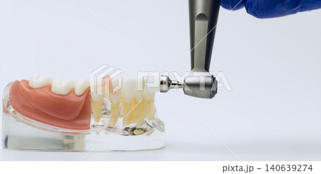 Dental Handpiece Polishing Tooth Surface on Jaw Model Dental Handpiece Polishing Tooth Surface on Jaw Model 140639274