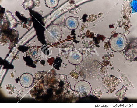 空気中の埃や塵に混ざっているスギ花粉 空気中の埃や塵に混ざっているスギ花粉 140649454