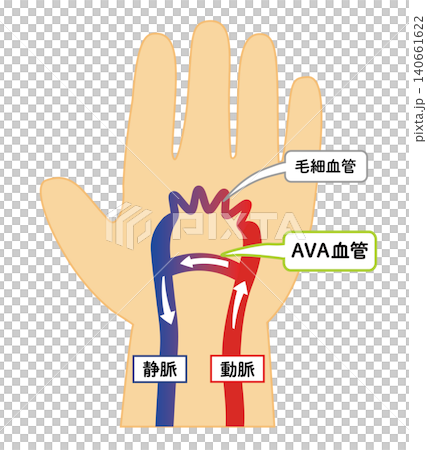 熱中症対策 AVA血管の仕組み 解説イラスト 手のひら冷却 動静脈吻合 ベクター 140661622