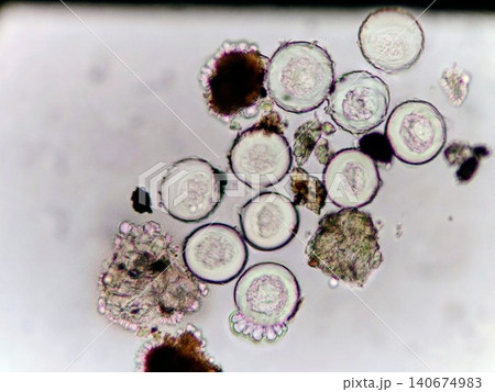 スギの花粉の顕微鏡観察様子 スギの花粉の顕微鏡観察様子 140674983