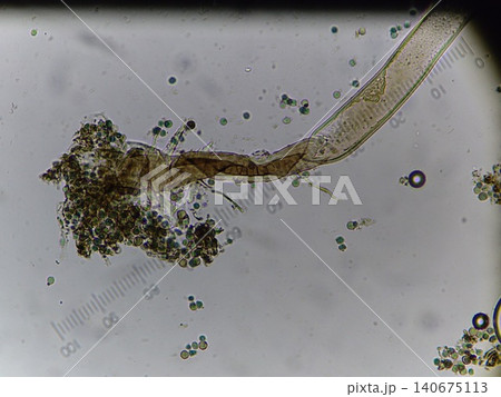 つぶれてしまったコウジカビの分生子 つぶれてしまったコウジカビの分生子 140675113