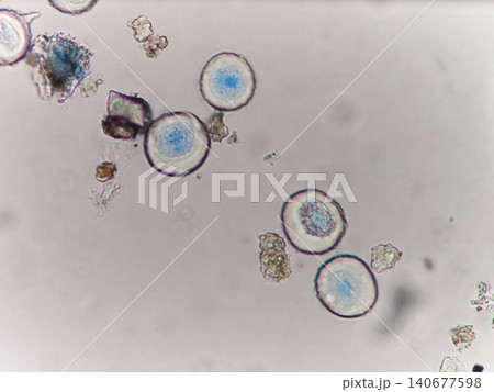 スギ花粉の顕微鏡写真 スギ花粉の顕微鏡写真 140677598