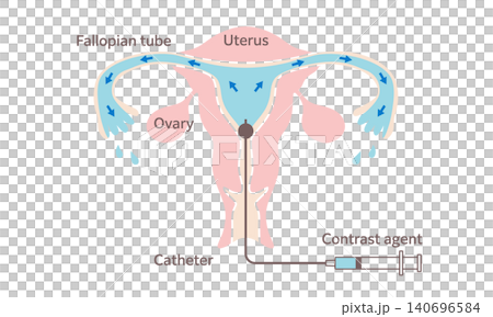 gynecology, vector, vectors 140696584