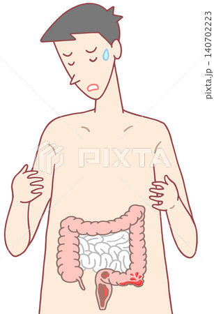 病気・疾患・疾病 - 血便・下血・大腸内出血 140702223
