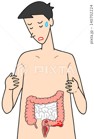病気・疾患・疾病 - 血便・下血・大腸内出血 140702224