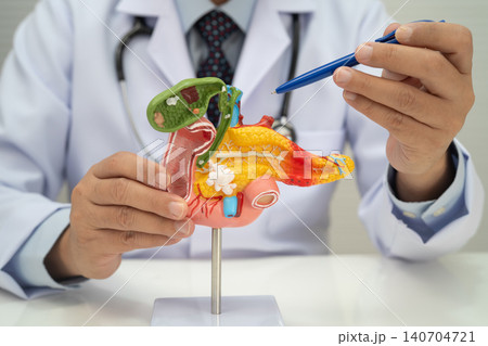 Pancreatitis, pancreatic cancer, Asian doctor with pancreas, gallbladder and bile duct human anatomy model at hospital. Pancreatitis, pancreatic cancer, Asian doctor with pancreas, gallbladder and bile duct human anatomy model at hospital. 140704721