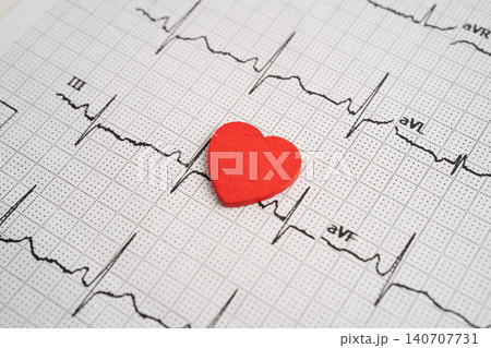Electrocardiogram ECG, heart wave, heart attack, cardiogram report. Electrocardiogram ECG, heart wave, heart attack, cardiogram report. 140707731