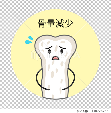 A circular illustration of bones that are suffering from bone loss. 140728767