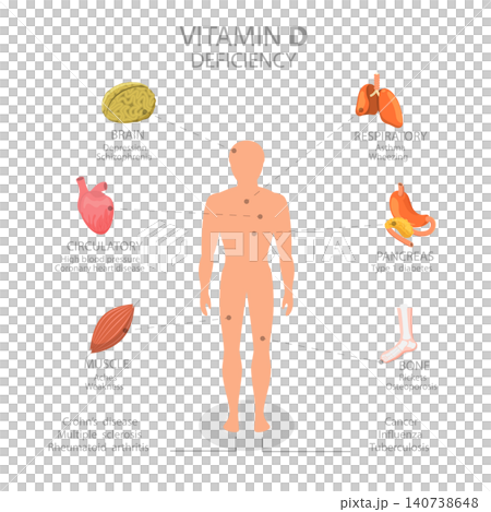 3D Isometric Flat Illustration of Vitamin D Deficiency, Leading To Health Problems And Complications 3D Isometric Flat Illustration of Vitamin D Deficiency, Leading To Health Problems And Complications 140738648