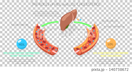 3D Isometric Flat Illustration of HDL And LDL Cholesterol, Transport And Plaque Formation Demonstrated With Visuals 3D Isometric Flat Illustration of HDL And LDL Cholesterol, Transport And Plaque Formation Demonstrated With Visuals 140738672