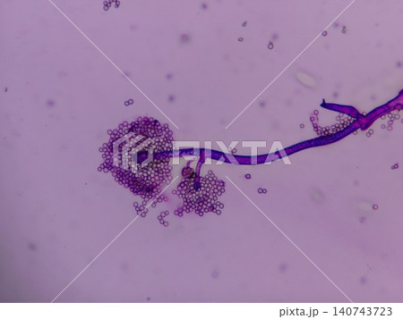 クモノスカビの染色された様子 クモノスカビの染色された様子 140743723