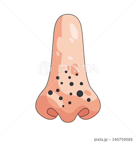 Illustration of nose with blackheads 140750088