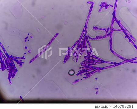 子嚢菌類の顕微鏡観察 子嚢菌類の顕微鏡観察 140799281