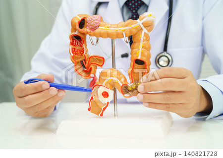 Colorectal cancer, doctor holding intestine colon human anatomy model. 140821728