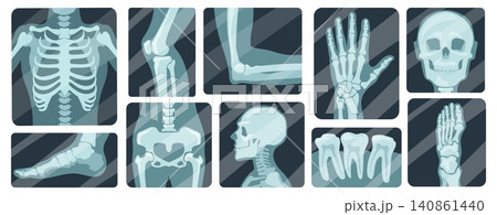 X ray radiography. Bone skeleton anatomy medical scan, arm leg foot hand knee elbow joint fracture hospital diagnosis treatment surgery human body health neat vector illustration X ray radiography. Bone skeleton anatomy medical scan, arm leg foot hand knee elbow joint fracture hospital diagnosis treatment surgery human body health neat vector illustration 140861440