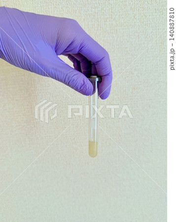 スピッツを持つ手 スピッツを持つ手 140887810
