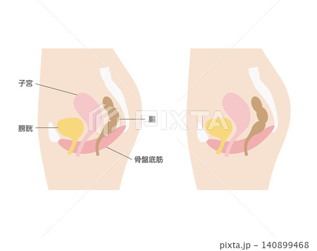 女性骨盤の断面図イラスト(子宮・膀胱・腸・骨盤底筋) 女性骨盤の断面図イラスト(子宮・膀胱・腸・骨盤底筋) 140899468