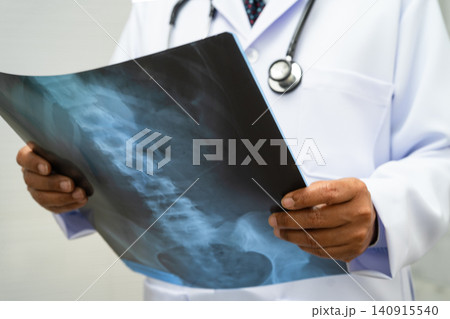 Doctor examining spine bone radiography xray film. Doctor examining spine bone radiography xray film. 140915540