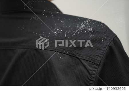 Man with dandruff on shirt at shoulder. Man with dandruff on shirt at shoulder. 140932693