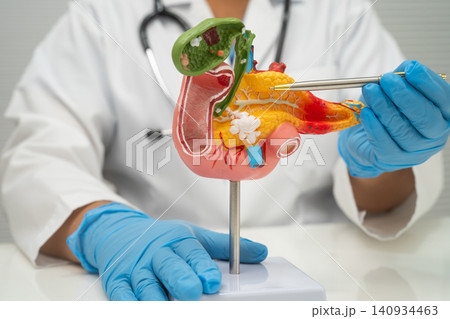 Pancreatitis, pancreatic cancer, Asian doctor with pancreas, gallbladder and bile duct human anatomy model at hospital. Pancreatitis, pancreatic cancer, Asian doctor with pancreas, gallbladder and bile duct human anatomy model at hospital. 140934463