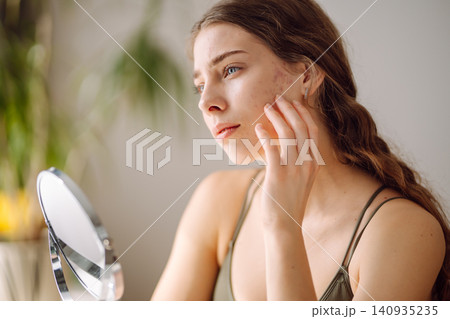 Young woman with problem skin looking into mirror. Inflammation on face, problem skin. Beauty care. Young woman with problem skin looking into mirror. Inflammation on face, problem skin. Beauty care. 140935235