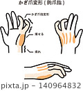 かぎ爪変形(鉤爪指) 140964832