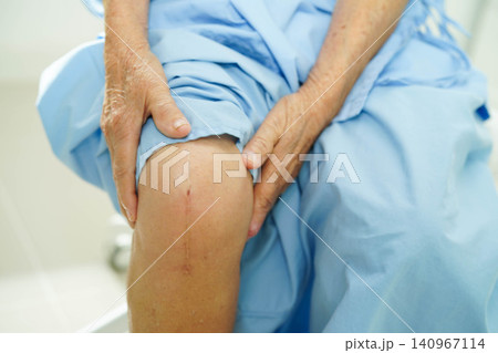 Asian elderly woman patient with scar knee replacement surgery in hospital. Asian elderly woman patient with scar knee replacement surgery in hospital. 140967114
