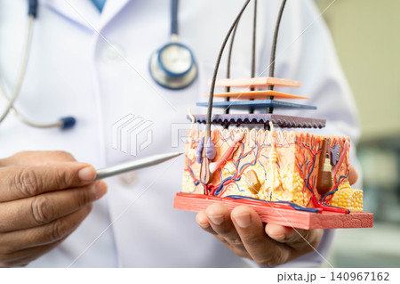 Hair transplant, Asian dermatologist doctor holding skin structure anatomy model for treatment in hospital. Hair transplant, Asian dermatologist doctor holding skin structure anatomy model for treatment in hospital. 140967162