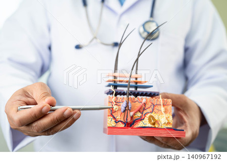 Hair transplant, Asian dermatologist doctor holding skin structure anatomy model for treatment in hospital. Hair transplant, Asian dermatologist doctor holding skin structure anatomy model for treatment in hospital. 140967192