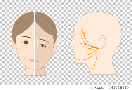 A comparative illustration of facial asymmetry caused by facial nerve paralysis and the facial nerve itself. A comparative illustration of facial asymmetry caused by facial nerve paralysis and the facial nerve itself. 141016119