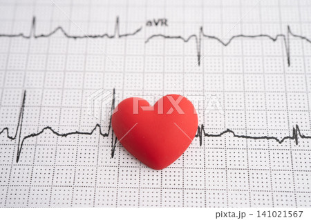Electrocardiogram ECG, heart wave, heart attack, cardiogram report. Electrocardiogram ECG, heart wave, heart attack, cardiogram report. 141021567