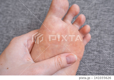 Hand supporting foot with Painful Blister on Neutral Background 141035626