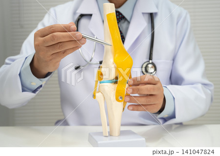 Osteoarthritis of the knee, Doctor holding human knee joint orthopedic anatomy model in hospital. Osteoarthritis of the knee, Doctor holding human knee joint orthopedic anatomy model in hospital. 141047824