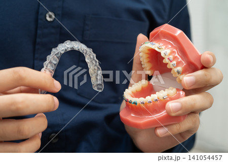 Man holding invisible aligner orthodontic retainer for dental teeth straightening. Man holding invisible aligner orthodontic retainer for dental teeth straightening. 141054457