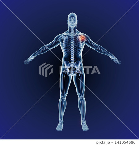 Shoulder pain, skeleton and graphic of body for xray, exam and analysis in medical overlay. 3D of human anatomy, radiology and red illustration of injury or physiotherapy on a dark or blue background Shoulder pain, skeleton and graphic of body for xray, exam and analysis in medical overlay. 3D of human anatomy, radiology and red illustration of injury or physiotherapy on a dark or blue background 141054686