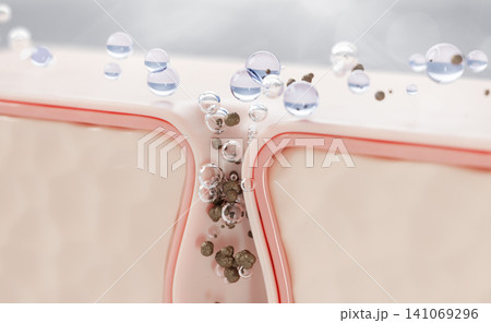 3d acne skin with clogged pore and water bubbles for acne treatment face wash. Salicylic acid cleanser, clear blue gel serum drops. Blackhead scrub, cosmetic skincare product render. 3D illustration 141069296