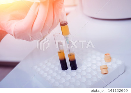 Platelet-Rich plasma preparation. Plasma in syringe. Centrifuge. Platelet-Rich plasma preparation. Plasma in syringe. Centrifuge. 141132699