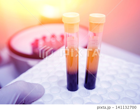 Platelet-Rich plasma preparation. Tube with blood in hands. Centrifuge. 141132700