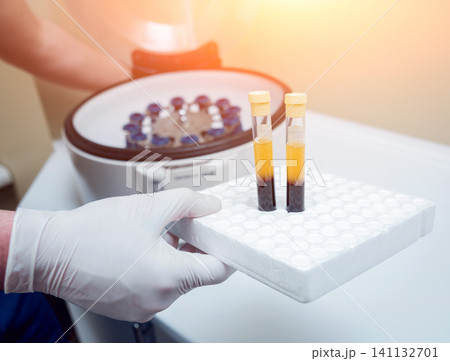 Platelet-Rich plasma preparation. Tube with blood in hands. Centrifuge. Platelet-Rich plasma preparation. Tube with blood in hands. Centrifuge. 141132701