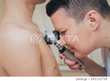Dermatologist examines patient birthmark with dermatoscope. Dermatologist examines patient birthmark with dermatoscope. 141132738