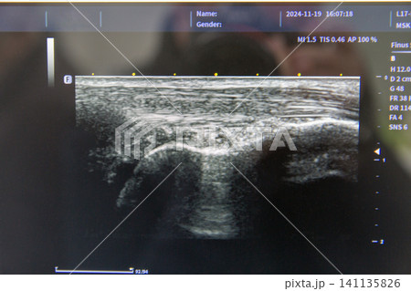 Medical ultrasound imaging of human musculoskeletal structure. Medical ultrasound imaging of human musculoskeletal structure. 141135826