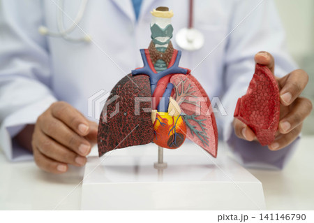 Pneumonia, lung cancer, Asian doctor holding human anatomy model for study diagnosis and treatment in hospital. Pneumonia, lung cancer, Asian doctor holding human anatomy model for study diagnosis and treatment in hospital. 141146790