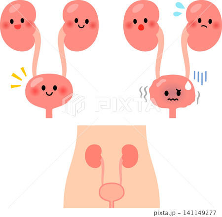 健康な膀胱と弱った膀胱のキャラクター 健康な膀胱と弱った膀胱のキャラクター 141149277