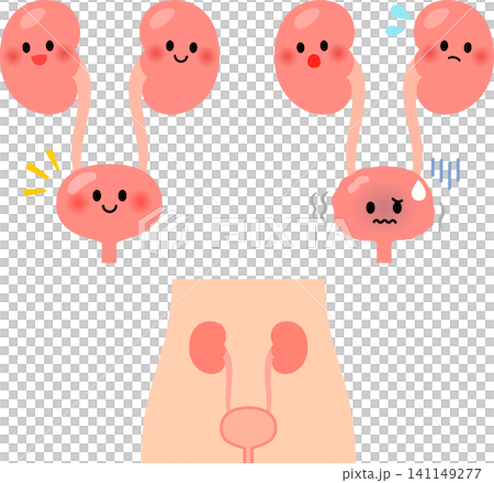 健康な膀胱と弱った膀胱のキャラクター 健康な膀胱と弱った膀胱のキャラクター 141149277