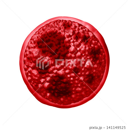 Cyclosporiasis Cyclosporiasis 141149525