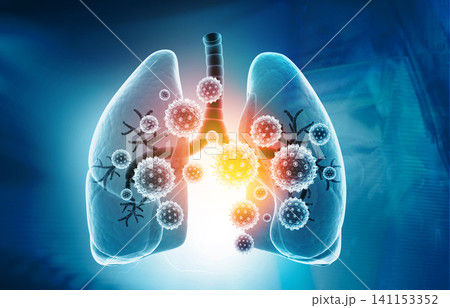 Viral lung infections, lung infection conept Viral lung infections, lung infection conept 141153352