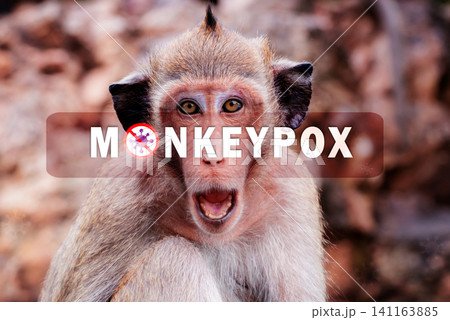 Monkeypox outbreak concept. Monkeypox is caused by monkeypox virus. Monkeypox is a viral zoonotic disease. Virus transmitted to humans from animals. Monkeys may harbor the virus and infect people. Monkeypox outbreak concept. Monkeypox is caused by monkeypox virus. Monkeypox is a viral zoonotic disease. Virus transmitted to humans from animals. Monkeys may harbor the virus and infect people. 141163885