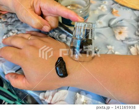 Person undergoing hirudotherapy, applying a leech on their arm for traditional medicine and alternative health treatment, with other leeches contained under a glass. Person undergoing hirudotherapy, applying a leech on their arm for traditional medicine and alternative health treatment, with other leeches contained under a glass. 141165938